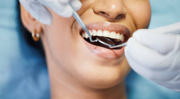Best Emergency Tooth Extraction in Fairview, TN